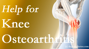Dr. Paulette Hugulet, DC, LLC shares recent studies regarding the exercise suggestions for knee osteoarthritis relief, even exercising the healthy knee for relief in the painful knee!