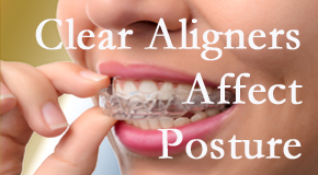 Clear aligners influence posture which La Grande chiropractic helps.