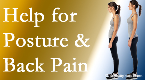 Poor posture and back pain are linked and find help and relief at Paulette Hugulet, DC, LLC.