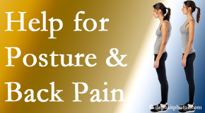 Poor posture and back pain are linked and find help and relief at Dr. Paulette Hugulet, DC, LLC.