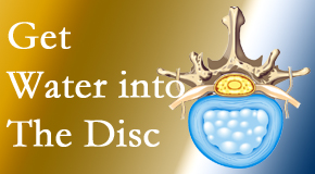 Paulette Hugulet, DC, LLC uses spinal manipulation and exercise to boost the diffusion of water into the disc which helps the health of the disc.