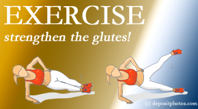 Dr. Paulette Hugulet, DC, LLC determines which muscles – like the gluteus max and medius - are weak for back pain sufferers and which exercises best help strengthen them.