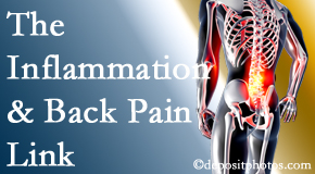 Paulette Hugulet, DC, LLC tackles the inflammatory process that accompanies back pain as well as the pain itself.