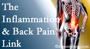 Dr. Paulette Hugulet, DC, LLC addresses the inflammatory process that accompanies back pain as well as the pain itself.