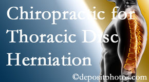 Dr. Paulette Hugulet, DC, LLC diagnoses and manages thoracic disc herniation pain and relieves its symptoms like unexplained abdominal pain or other gastrointestinal issues.