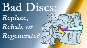 Dr. Paulette Hugulet, DC, LLC offers conservative care for degenerated, bad discs to help back pain sufferers enjoy their lives now.