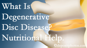 Paulette Hugulet, DC, LLC treats degenerative disc disease with chiropractic treatment and nutritional interventions. 