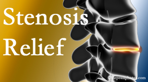 Dr. Paulette Hugulet, DC, LLC offers research-recommended treatment – Cox® Technic – for relief of symptoms due to spinal stenosis.