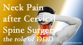 Paulette Hugulet, DC, LLC offers gentle treatment for neck pain after neck surgery.