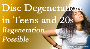 Dr. Paulette Hugulet, DC, LLC manages back pain due to disc degeneration in younger people in their teens and 20s.