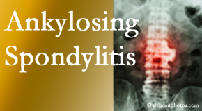 Ankylosing spondylitis is gently cared for by your La Grande chiropractor.