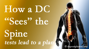 Dr. Paulette Hugulet, DC, LLC will use any combination of a variety of means to see the spine and diagnose its underlying pain issue to set a course for pain relief.