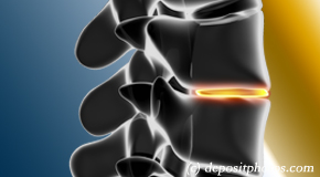 La Grande degenerative spinal changes 