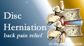 Paulette Hugulet, DC, LLC offers non-surgical treatment for relief of disc herniation related back pain. 