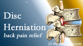 Dr. Paulette Hugulet, DC, LLC offers non-surgical treatment for relief of disc herniation related back pain.