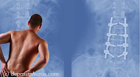 La Grande chiropractic relief for back pain after back surgery