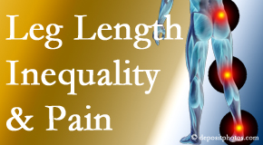 Dr. Paulette Hugulet, DC, LLC checks for leg length inequality as it is related to back, hip and knee pain issues.