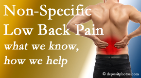 Dr. Paulette Hugulet, DC, LLC describes the specific characteristics and treatment of non-specific low back pain.