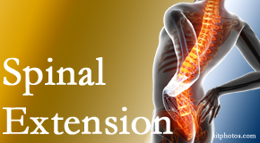 Paulette Hugulet, DC, LLC knows the role of extension in spinal motion, its necessity, its benefits and potential harmful effects. 
