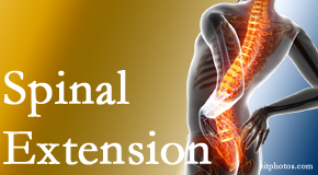 Dr. Paulette Hugulet, DC, LLC understands the role of extension in spinal motion, its necessity, its benefits and potential harmful effects.