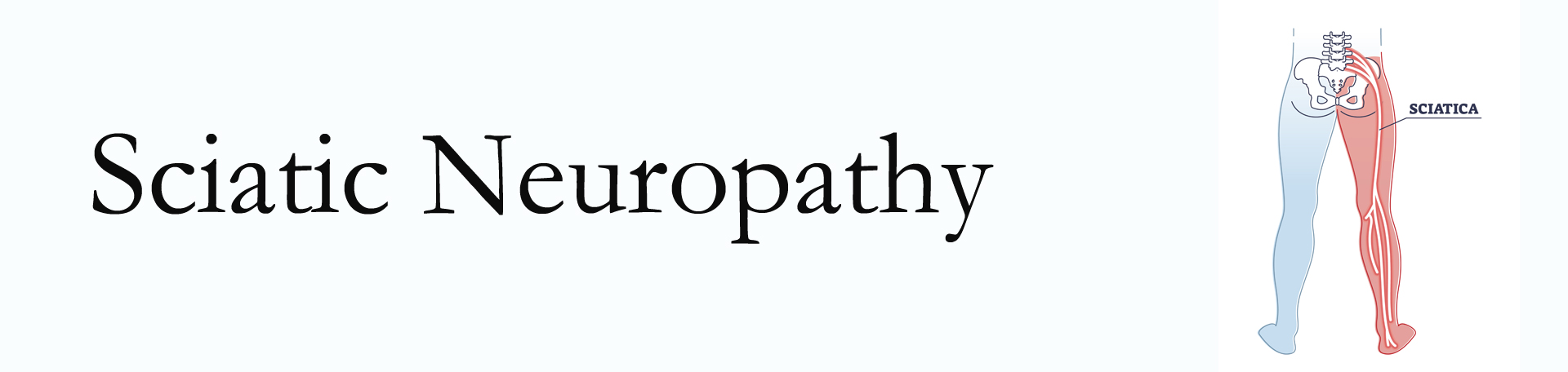 La Grande neuropathy pain (sciatica)