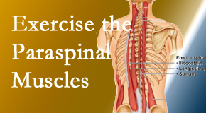 Dr. Paulette Hugulet, DC, LLC describes the importance of paraspinal muscles and their strength for La Grande back pain relief.