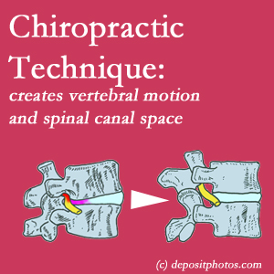 image of a La Grande spinal stenotic canal