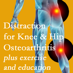 A chiropractic treatment plan for La Grande knee pain and hip pain caused by osteoarthritis: education, exercise, distraction.