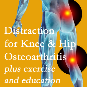A chiropractic treatment plan for La Grande knee pain and hip pain due to osteoarthritis: education, exercise, distraction.