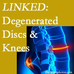 Degenerated discs and degenerated knees are not such unlikely companions. They are seen to be related. La Grande patients with a loss of disc height due to disc degeneration often also have knee pain related to degeneration. 