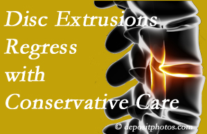 La Grande chiropractic care of extruded discs may help them regress and improve your quality of life.