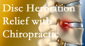 Paulette Hugulet, DC, LLC gently treats the disc herniation causing back pain. 